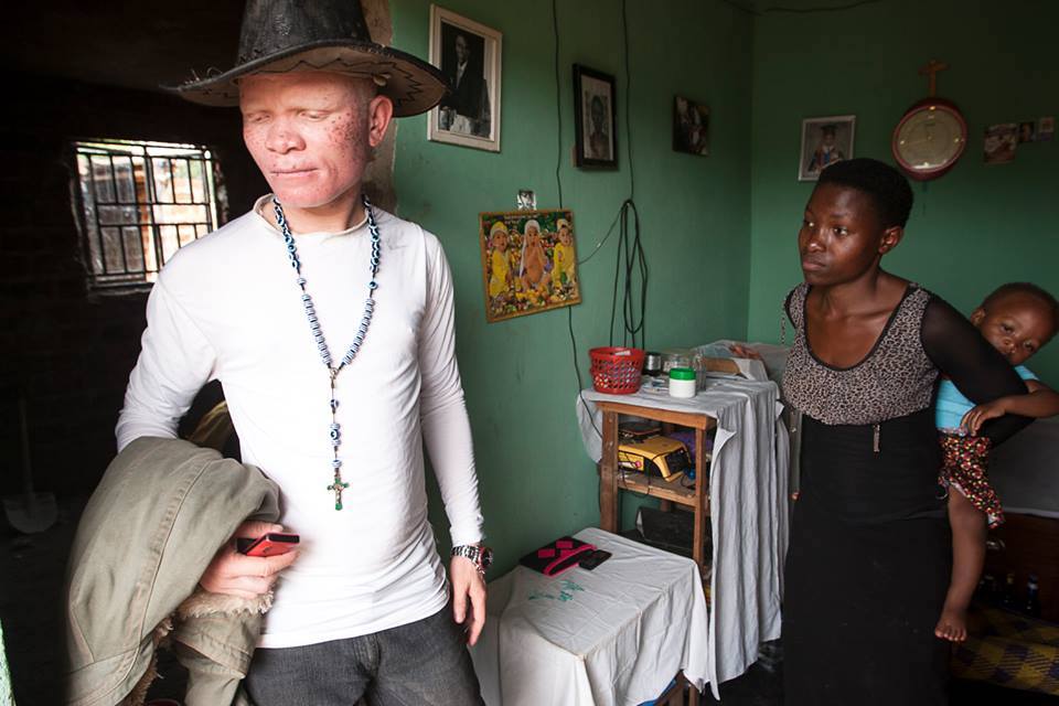 Paul the albino project