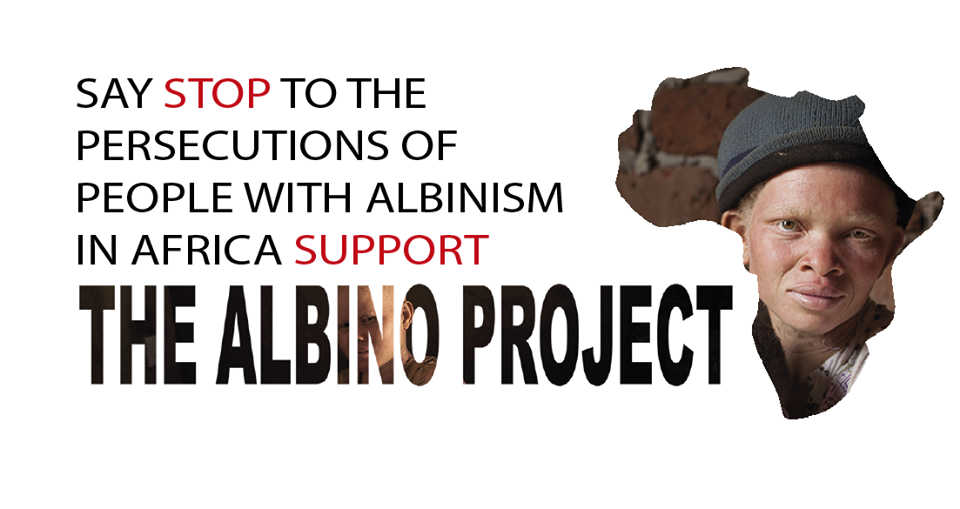 the albino project